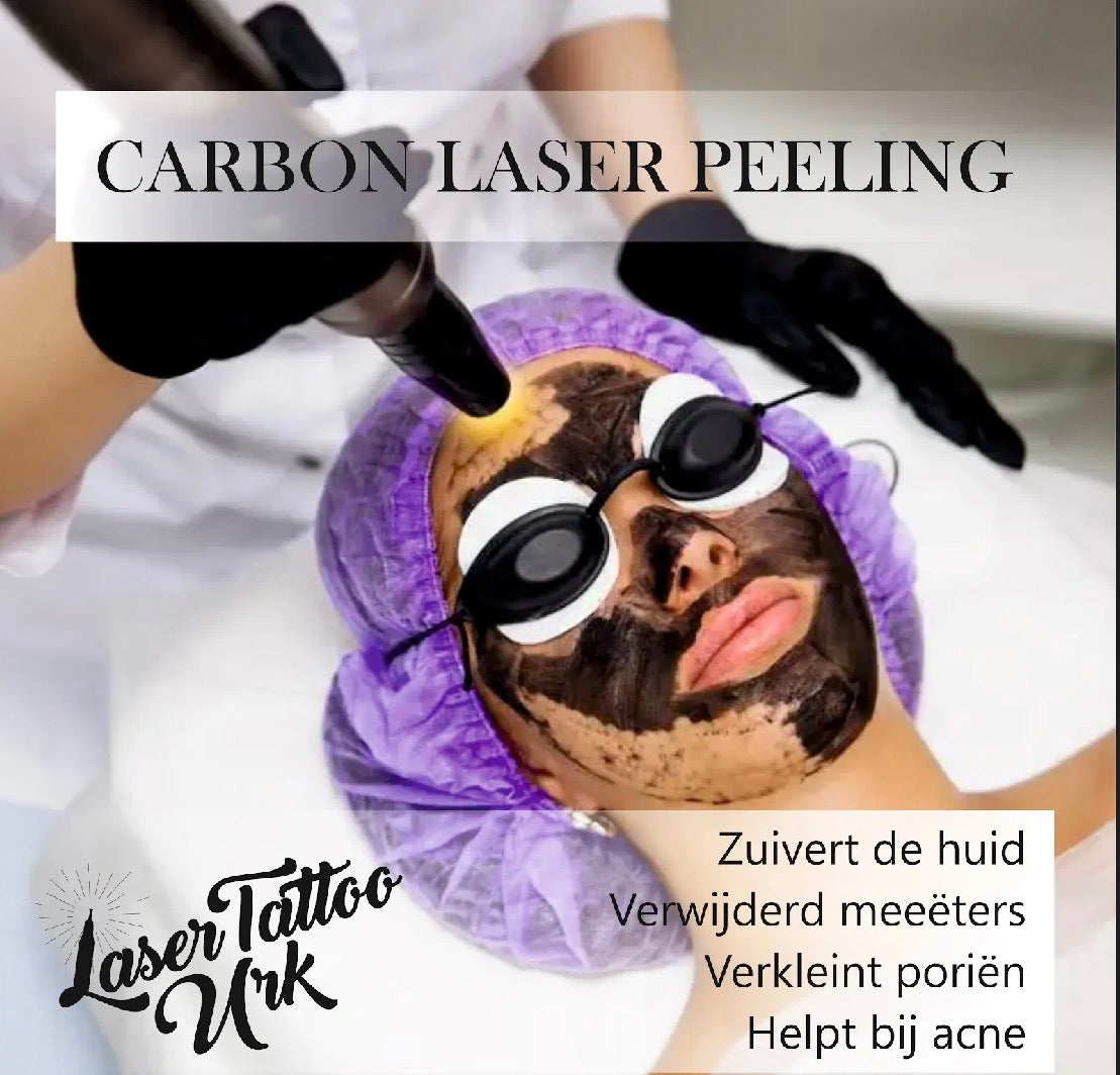 Carbon laser peeling